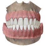 التقط صورة للفك العلوي والسفلي بحالة الاطباق