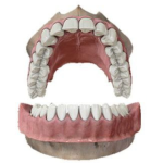 الفك العلوي