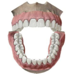 الفك السفلي